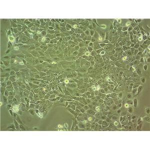 KP-N-NS Cells(赠送Str鉴定报告)|人肾上腺神经母细胞瘤细胞