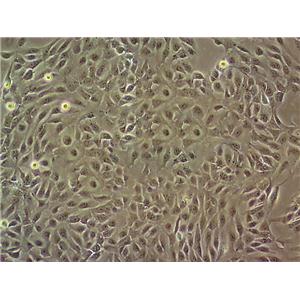 BeWo Cells(赠送Str鉴定报告)|人胎盘绒膜癌细胞