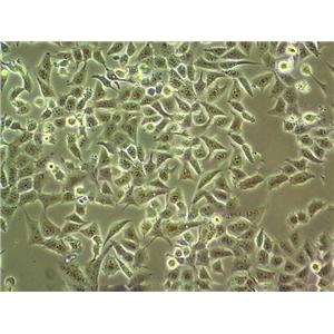 ME-180 Cells(赠送Str鉴定报告)|人子宫颈表皮癌细胞