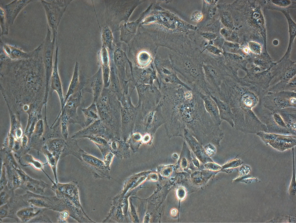 A-204 Cell|人橫紋肌肉瘤細(xì)胞,A-204 Cell