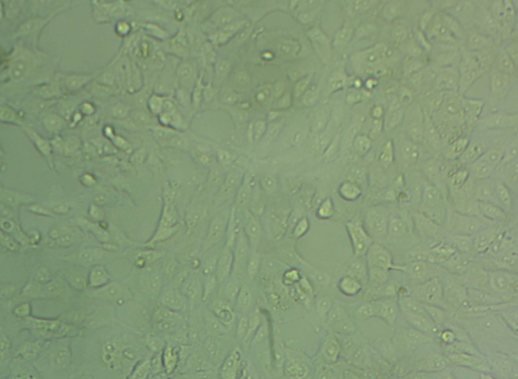 BCaP-37 Cell|人乳腺癌细胞,BCaP-37 Cell