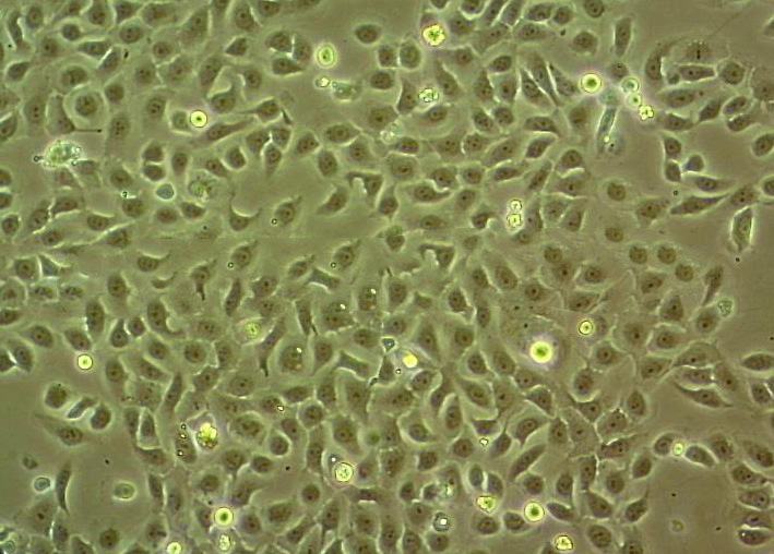 KYSE-150 Cell|人食管鳞癌细胞,KYSE-150 Cell