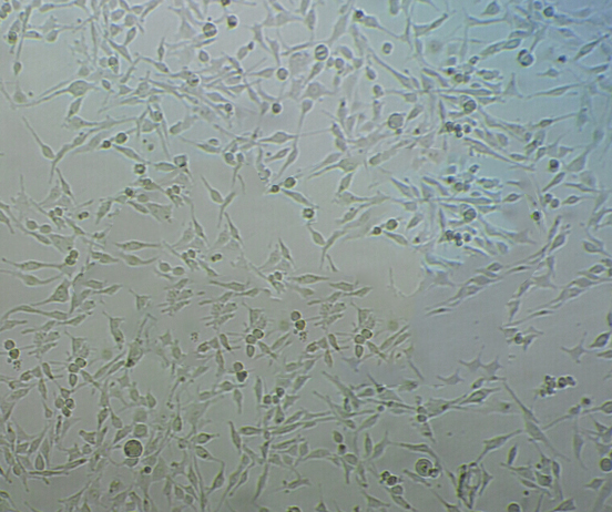 TE-1 Cell|人食管癌细胞,TE-1 Cell