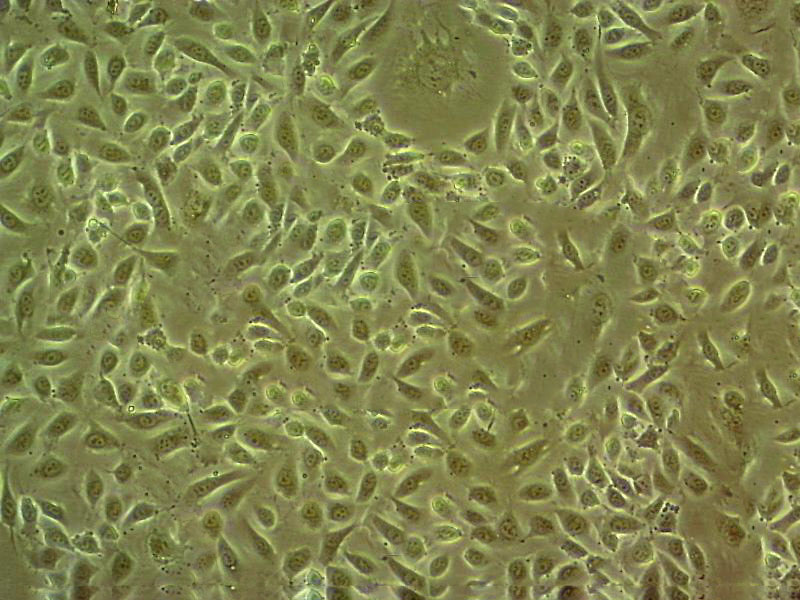 ARPE-19 Cell|人视网膜色素上皮细胞,ARPE-19 Cell