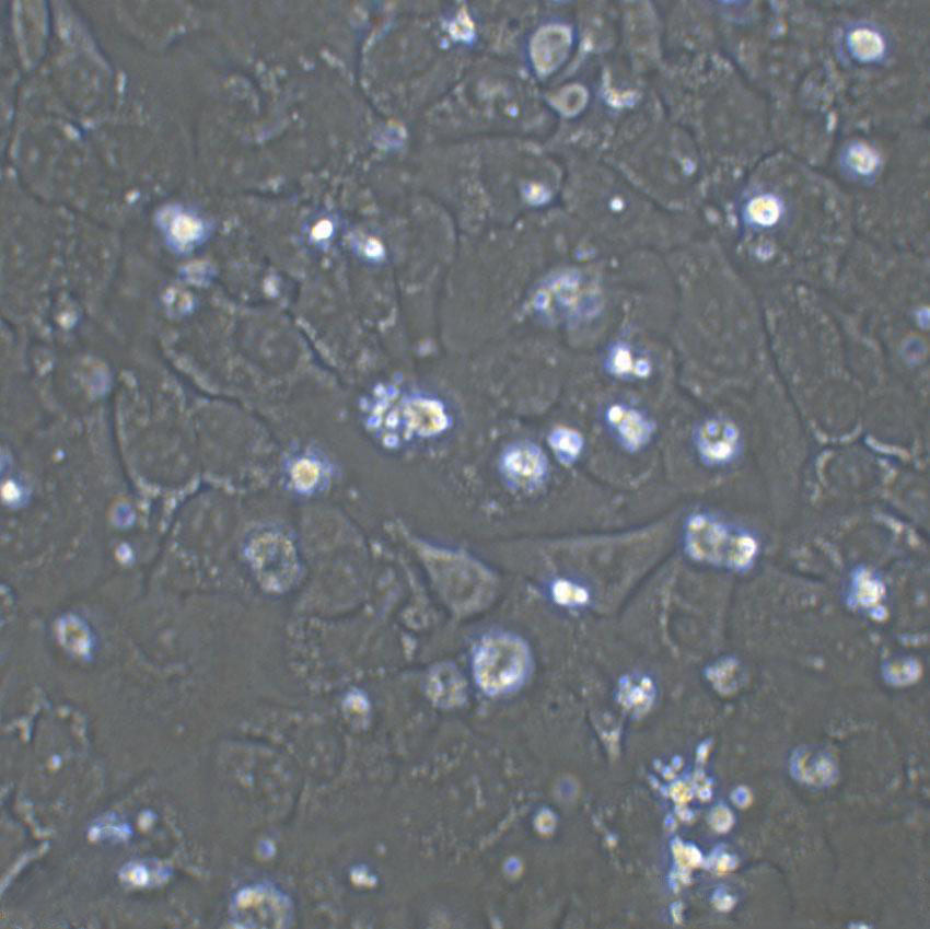 RL95-2 Cell|人子宫内膜癌细胞,RL95-2 Cell