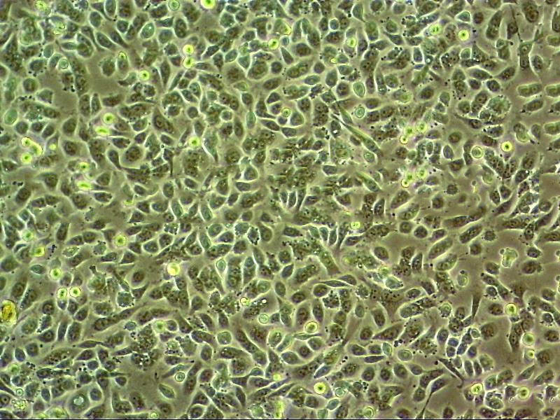 HEC-1-B Cell|人子宫内膜癌细胞,HEC-1-B Cell