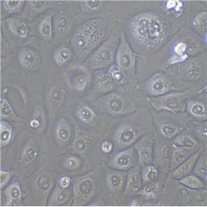 UM-UC-3 Cell|人膀胱移行癌细胞,UM-UC-3 Cell