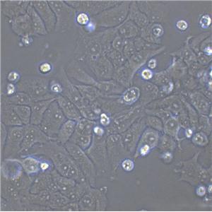 MCF-7 Cell|人乳腺癌细胞