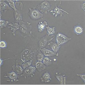 HBL-100 Cell|人整合SV40基因的乳腺上皮细胞