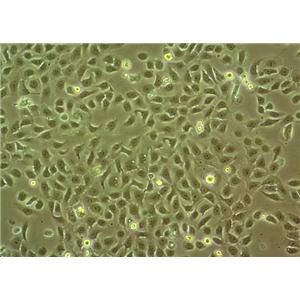 KYSE-150 Cell|人食管鳞癌细胞