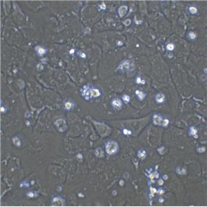 786-O Cell|人肾透明细胞腺癌细胞