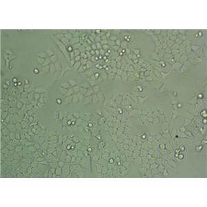 Ishikawa Cell|人子宫内膜癌细胞