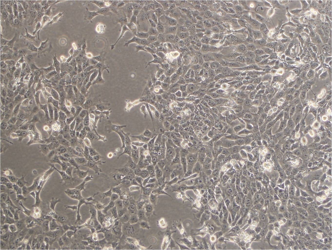 NCI-H2122 Cell|人肺癌细胞,NCI-H2122 Cell