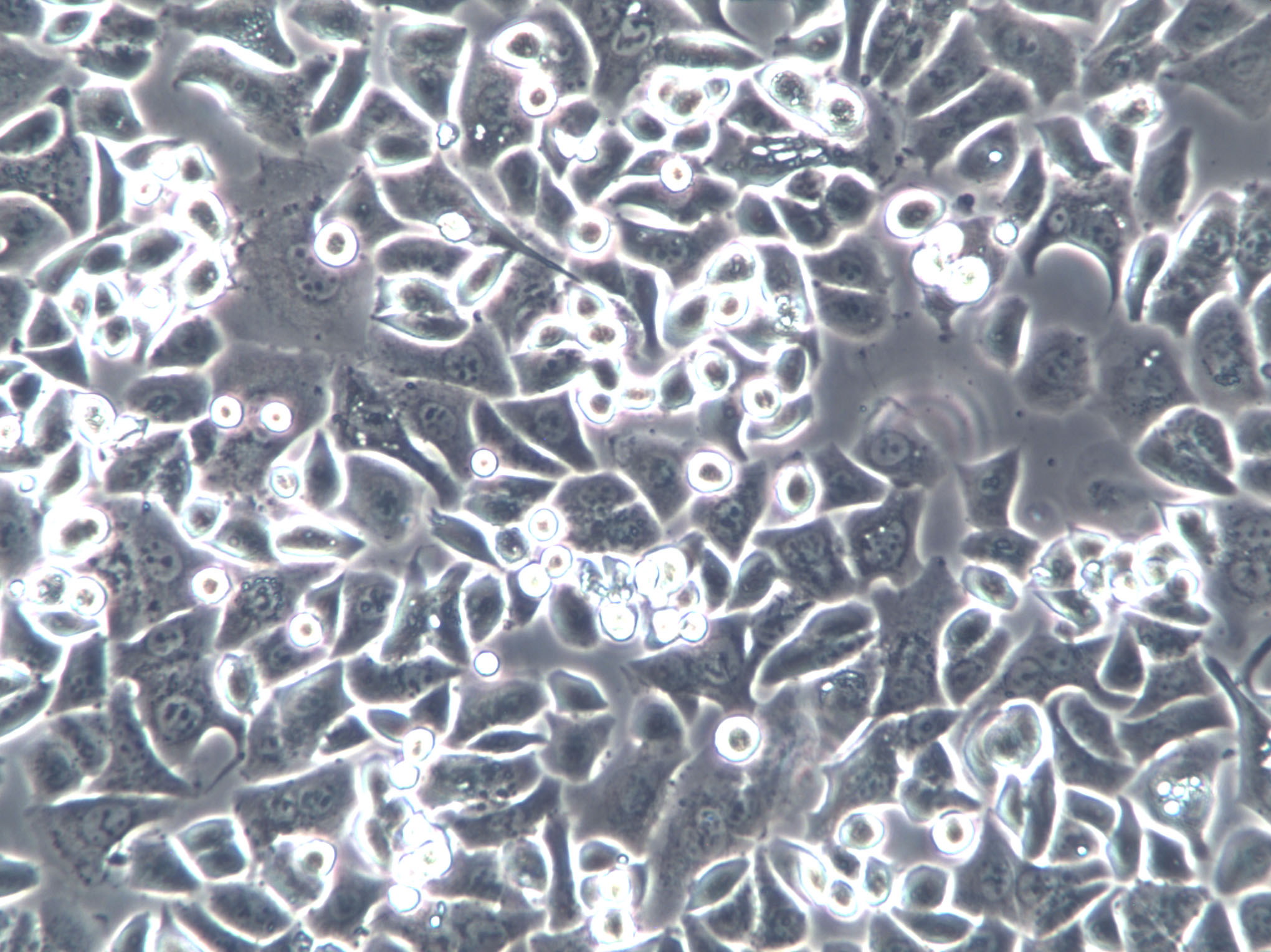 NCI-H2172 Cell|人非小细胞肺癌细胞,NCI-H2172 Cell