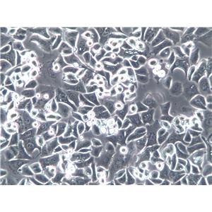 NCI-H2172 Cell|人非小细胞肺癌细胞