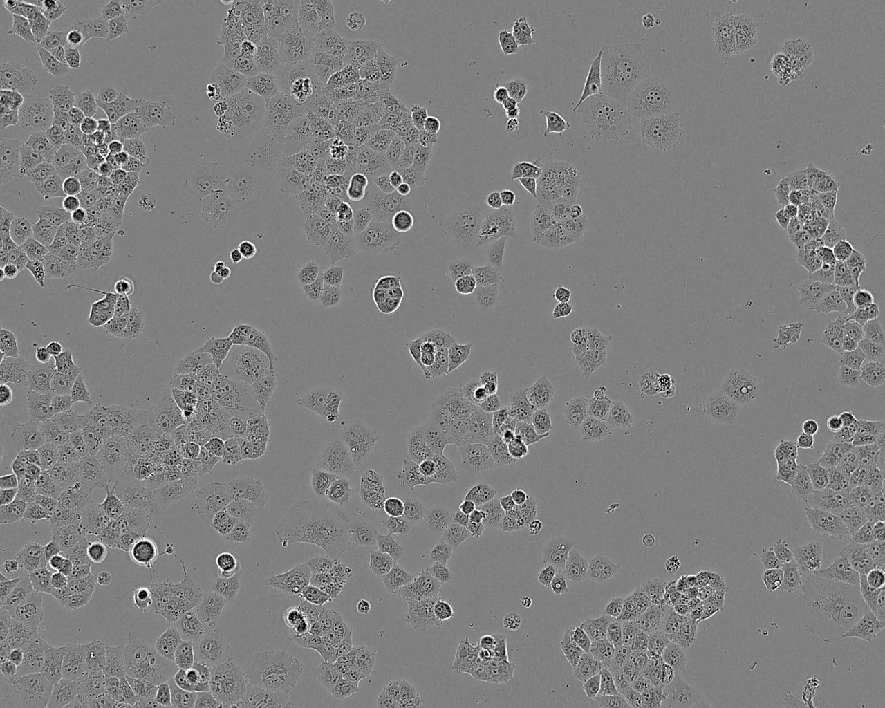NCI-H1618 Cell|人小细胞肺癌细胞,NCI-H1618 Cell