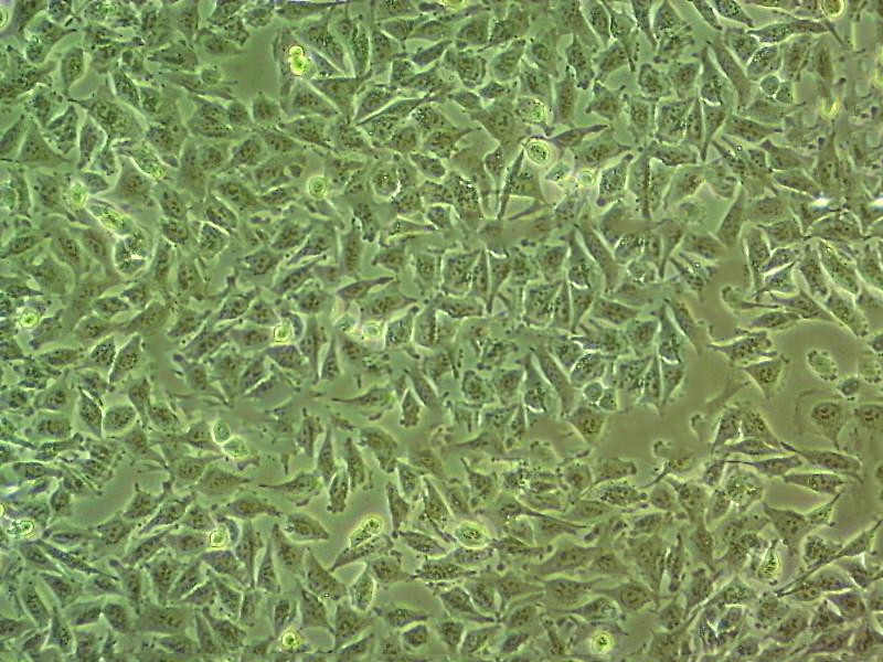 SKM-1 Cell|人骨髓增生异常综合征细胞,SKM-1 Cell