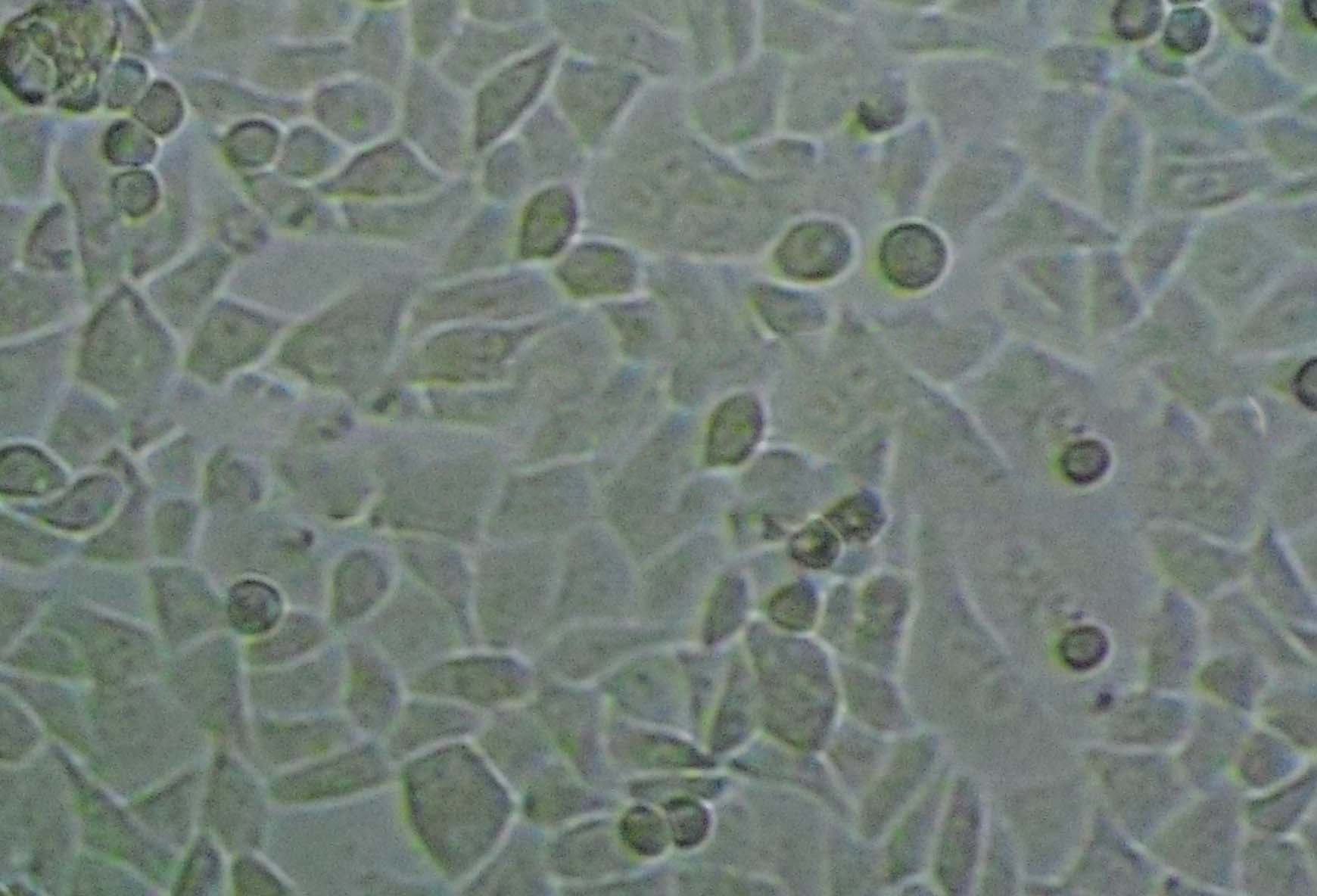 MDA-PCa-2b Cell|人前列腺癌细胞,MDA-PCa-2b Cell