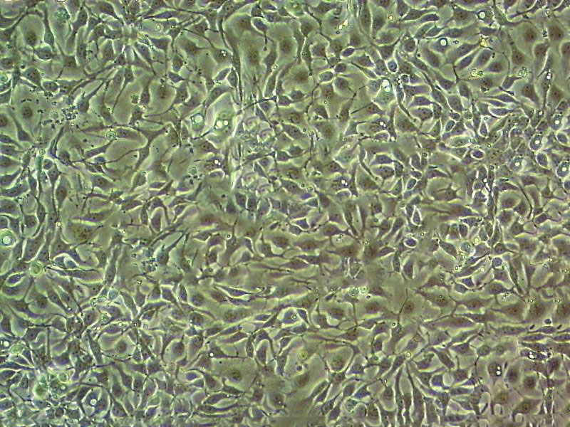 G-361 Cell|人黑色素瘤细胞,G-361 Cell