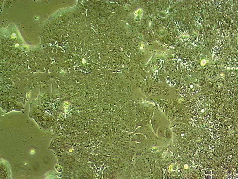 Malme-3M Cell|人恶性黑色素瘤细胞,Malme-3M Cell