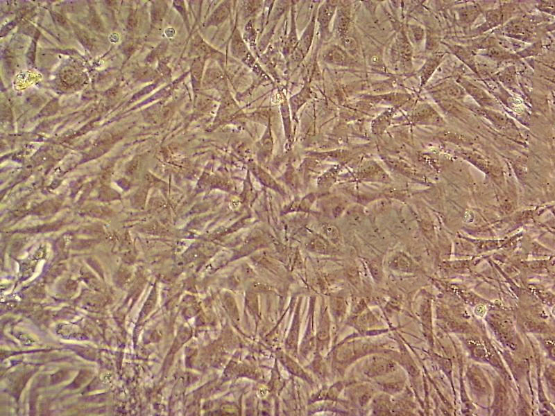 SK-MEL-1 Cell|人皮肤黑色素瘤细胞,SK-MEL-1 Cell