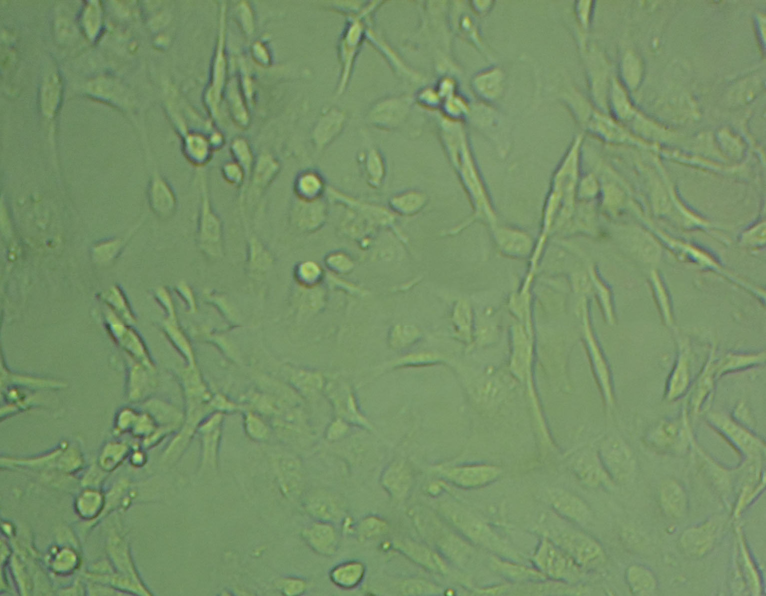 MKN7 Cell|人胃癌細胞,MKN7 Cell