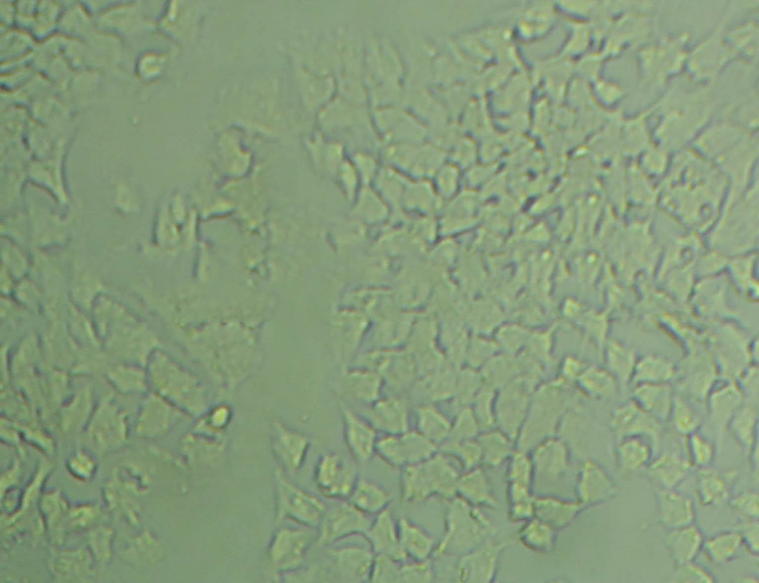 HSC-3 Cell|人口腔鳞癌细胞,HSC-3 Cell