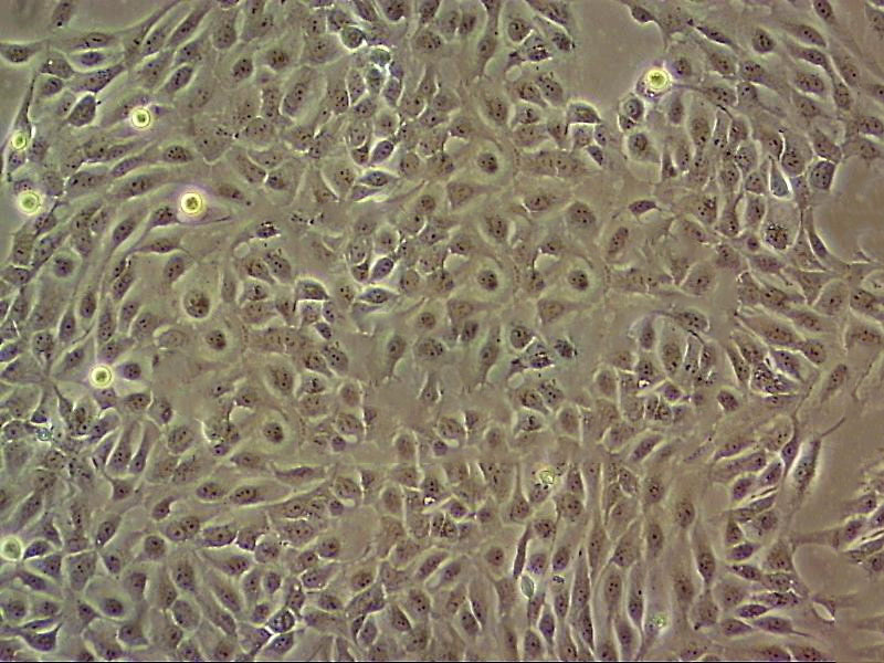 SCC-25 Cell|人口腔鳞癌细胞,SCC-25 Cell