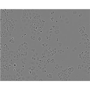 NCI-H1618 Cell|人小细胞肺癌细胞,NCI-H1618 Cell
