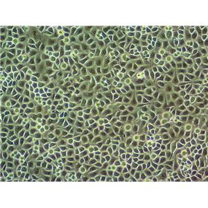 TOV-112D Cell|人上皮性卵巢癌细胞