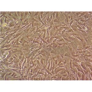 SK-MEL-1 Cell|人皮肤黑色素瘤细胞