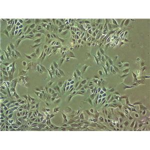 BpRc1 Cell|小鼠肝癌细胞
