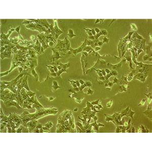 DMS 273 Cell|人小细胞肺癌细胞