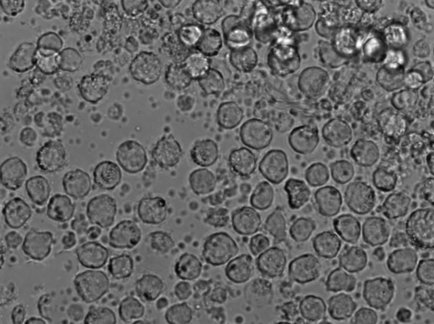 BALL-1:人B淋巴细胞急性白血病复苏细胞(提供STR鉴定图谱),BALL-1