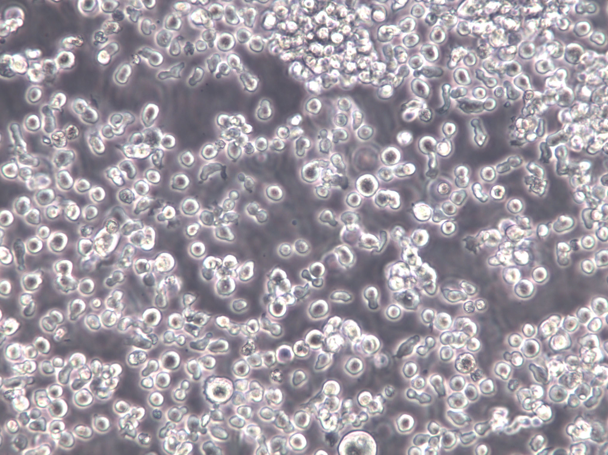 HH [Human lymphoma]:人皮肤T淋巴细胞瘤复苏细胞(提供STR鉴定图谱),HH [Human lymphoma]