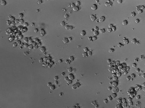 NCI-H929:人浆细胞白血病复苏细胞(提供STR鉴定图谱),NCI-H929