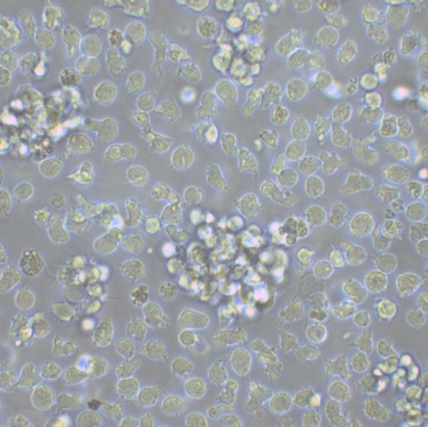 MOLT-3:人急性T淋巴细胞白血病复苏细胞(提供STR鉴定图谱),MOLT-3