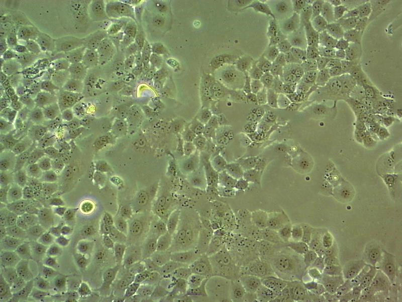 KP-4 Cell|人胰腺导管细胞癌细胞,KP-4 Cell