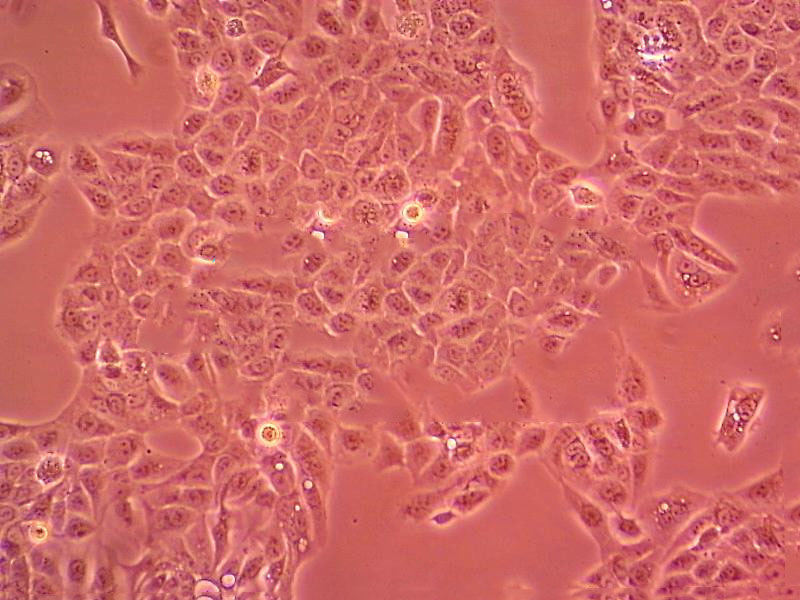 Lu-99A Cell|人大细胞肺癌细胞,Lu-99A Cell