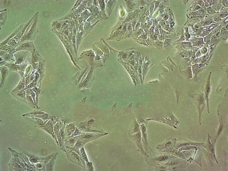 MES-SA/Dx5 Cell|人子宫肉瘤细胞,MES-SA/Dx5 Cell