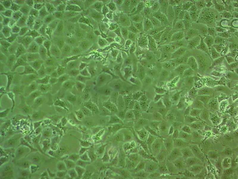 NCI-ADR-RES Cell|卵巢腺癌细胞,NCI-ADR-RES Cell