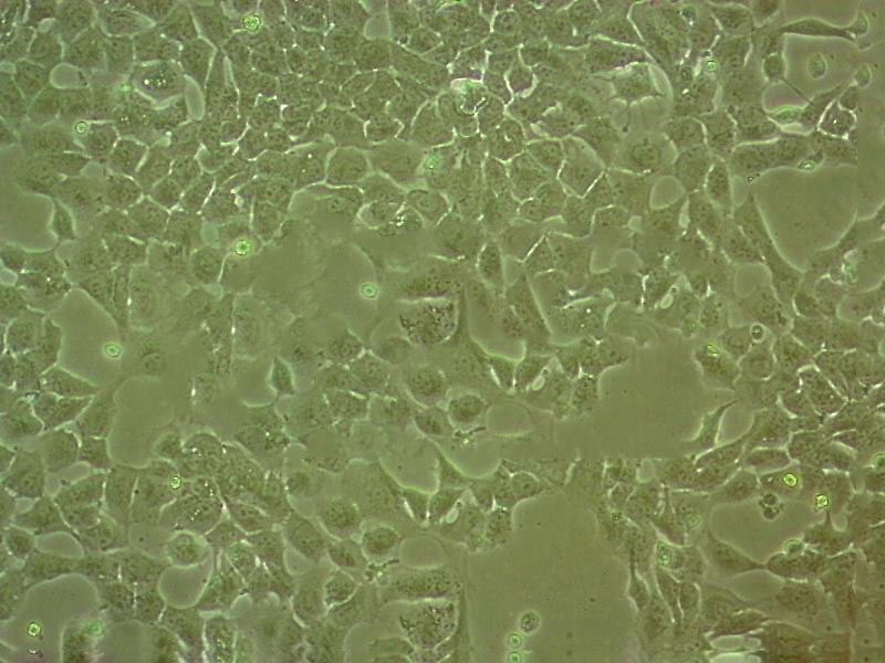 NeHepLxHT Cell|人正常干细胞,NeHepLxHT Cell