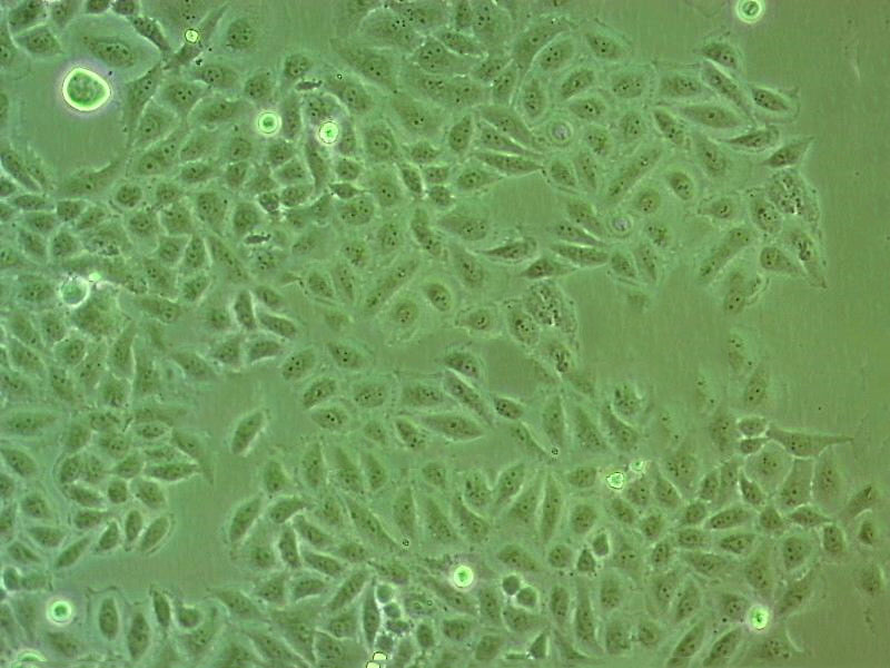 PE/CA-PJ34 (clone C12) Cell|人口腔鳞状细胞癌细胞,PE/CA-PJ34 (clone C12) Cell
