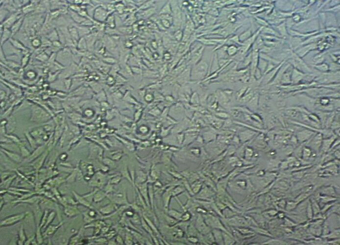 SNU-449 Cell|人肝癌细胞,SNU-449 Cell