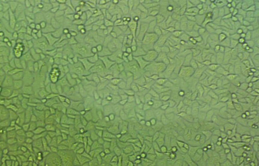 TE-15 Cell|人食管癌细胞,TE-15 Cell