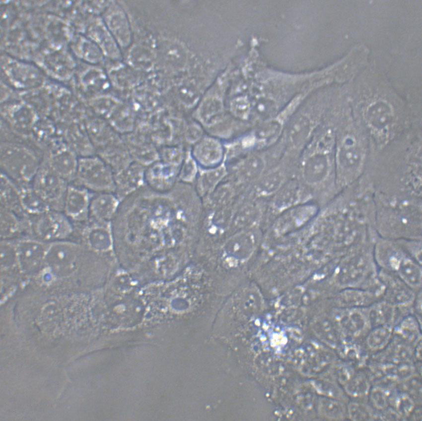 TE-9 Cell|人食管癌細(xì)胞,TE-9 Cell