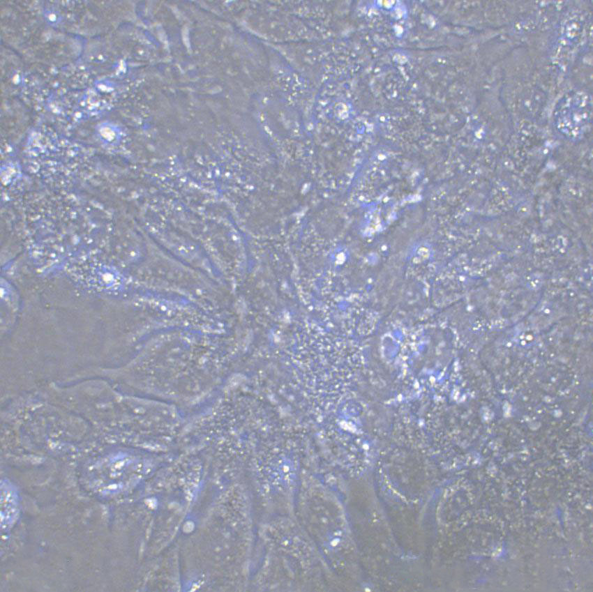 ECC10 Cell|人子宫内膜癌细胞,ECC10 Cell