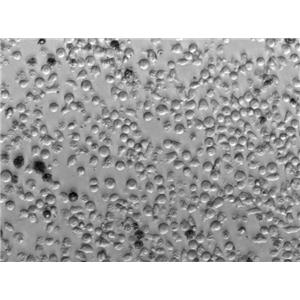 AML-193:人急性单核细胞白血病单核复苏细胞(提供STR鉴定图谱),AML-193