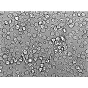 Loucy:人淋巴细胞白血病复苏细胞(提供STR鉴定图谱)
