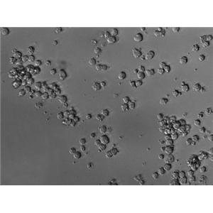 JM-1:人B淋巴细胞瘤复苏细胞(提供STR鉴定图谱)